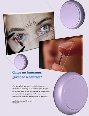 Implantación de chips en humanos 
