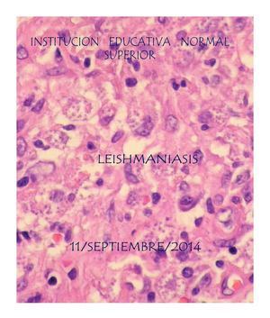 Leishmaniasis (Encuesta)