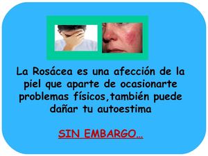 Remedios Caseros Para Curar La Rosacea - Como Puedo Evitar La Rosacea