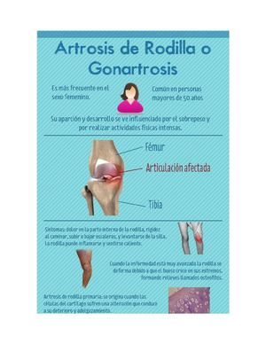 revista sobre artrosis de rodilla