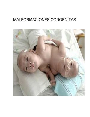 malformaciones congenicas