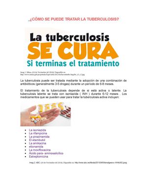 ¿Cómo Tratar La Tuberculosis?