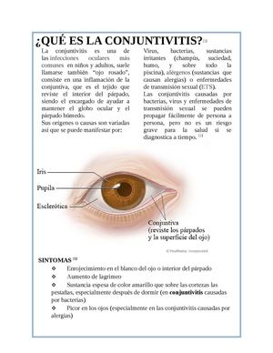 es la infección viral del ojo rosado es la infección viral del ojo rosado