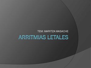 Arritmias