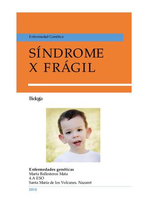Síndrome X Frágil
