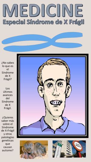 Revista Síndrome X Fragil