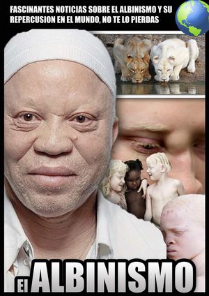 Revista Albinismo