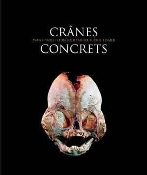 Crânes Concrets
