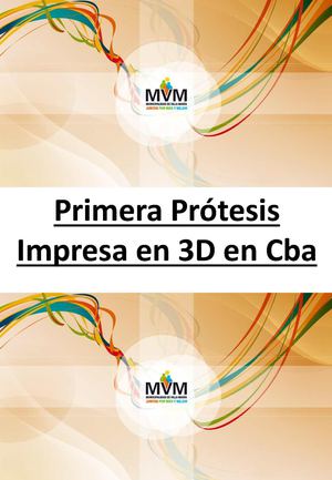 Primera Protesis Impresa En 3d En Cba