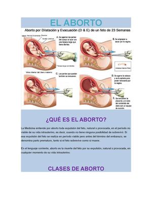 El Aborto