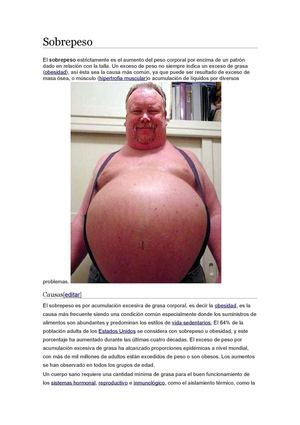 sobrepeso