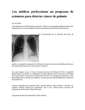 Los Médicos Perfeccionan Un Programa De Exámenes Para Detectar Cáncer De Pulmón