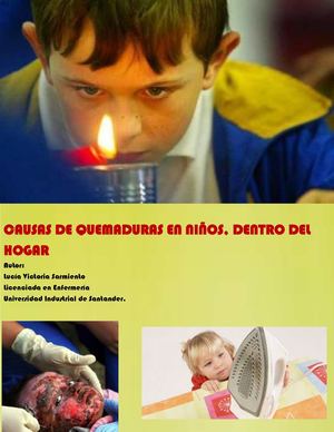 Causas de quemaduras en niños, dentro del hogar