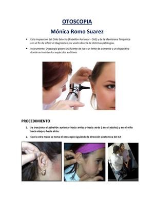 Otoscopia