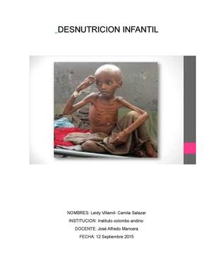 Desnutricion