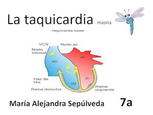 Taquicardi De bioligiaa