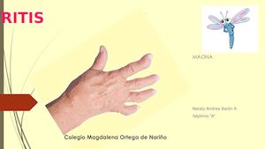 Portafolio de la Artritis
