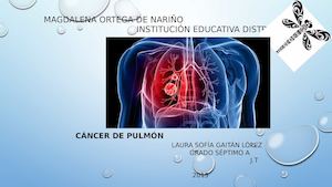 Magdalena Ortega De Nariño Cancer De Pulmon Institución Educativa Distrital