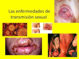 Revista De Las Enfermedades De Transmicion Sexual