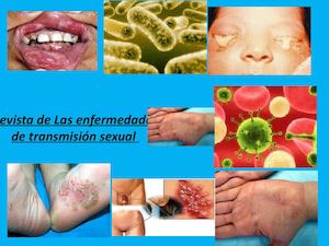 revista de Las Enfermedades De Trans Mición Sexual Y Me