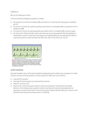 Patrones De Sobrecarga Ventricular