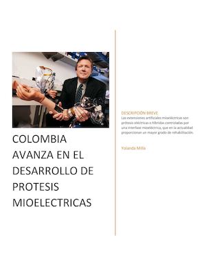 Prótesis Mioeléctricas