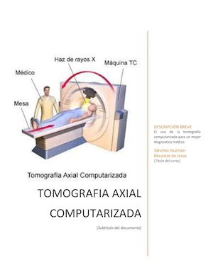 Tomografia axial computarizada