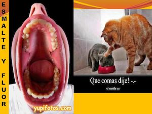 Esmalte Y Fluor Prevencion