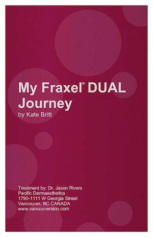 NAKED SKIN CLINIC Fraxel Patient Diary - Kate Britt