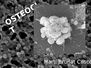Osteòcit Martí.