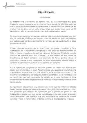 Hipertricosis