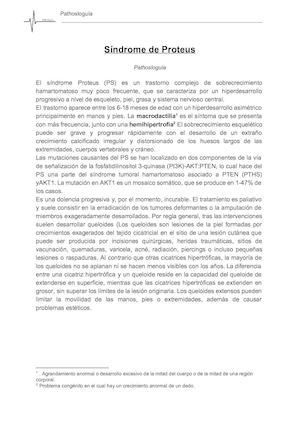 Síndrome De Proteus