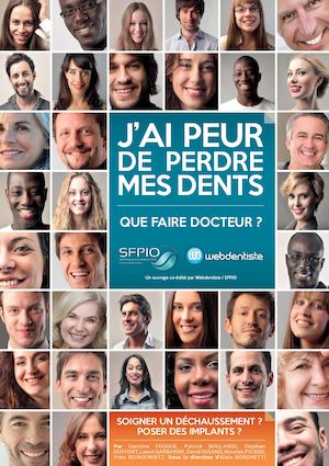 J'ai peur de perdre mes dents - Webdentiste
