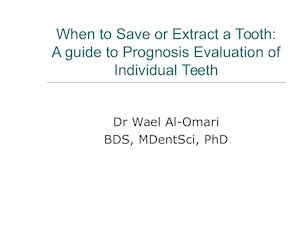 When To Save Or Extract A Tooth