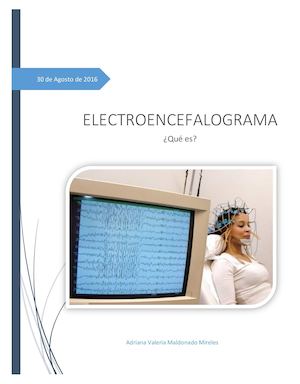 Electroencefalograma