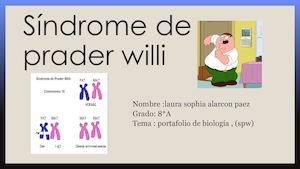 Síndrome De Prader Willi