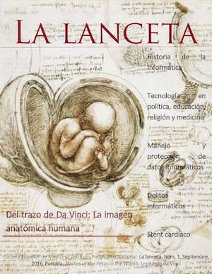 La Lanceta