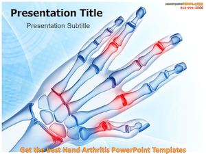 Get the best Hand Arthritis PowerPoint Templates