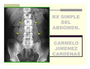 Estudioradiograficosimpledelabdomen