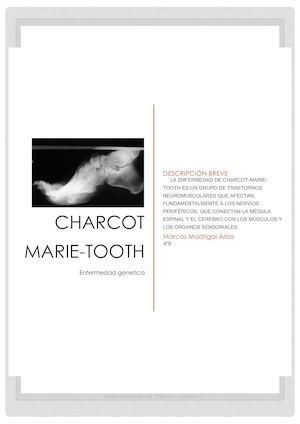 Charcot Marie Tooth