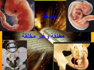 مضغة مخلقة وغير مخلقة