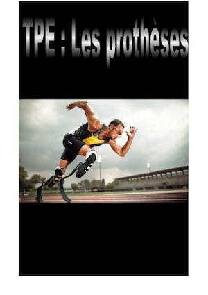 Tpe Les Prothèses S