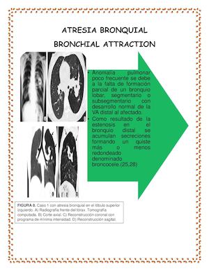 MALFORMACIONES DE LA VIA AEREA 2