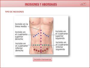 Incisiones Y Abordajes Gineco