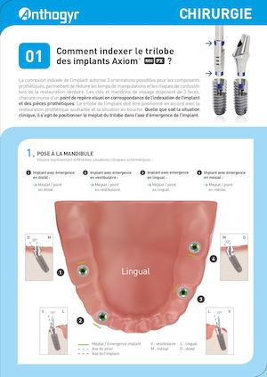 Indexation trilobe implants Axiom® REG/PX Anthogyr