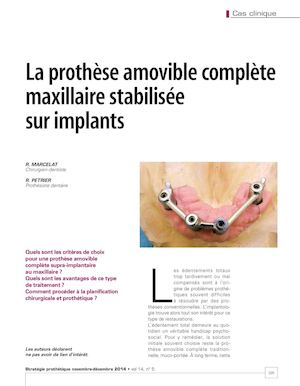 Prothèse amovible complète maxillaire stabilisé sur implants - Dr Richard MARCELAT - Stratégie Prothétique - Novembre 2014