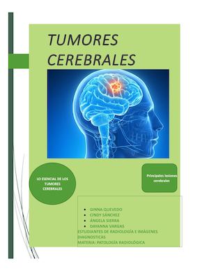 Tumores Cerebrales