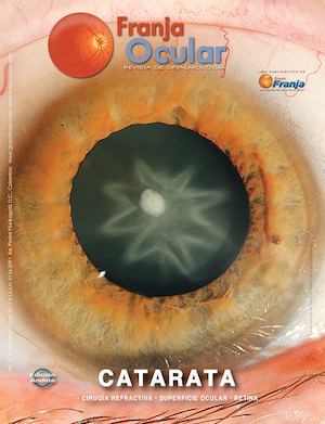 Franja Ocular No. 100