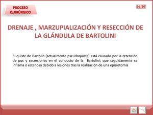 Drenaje, Marzupializacion Y Bartolinectomia
