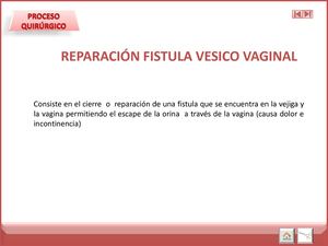 Reseccion Fistula Vesico Vaginal